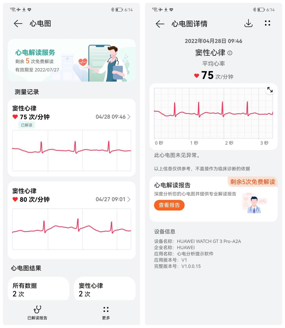 华为手表软件（华为手表连接软件）-第9张图片-欧交易所