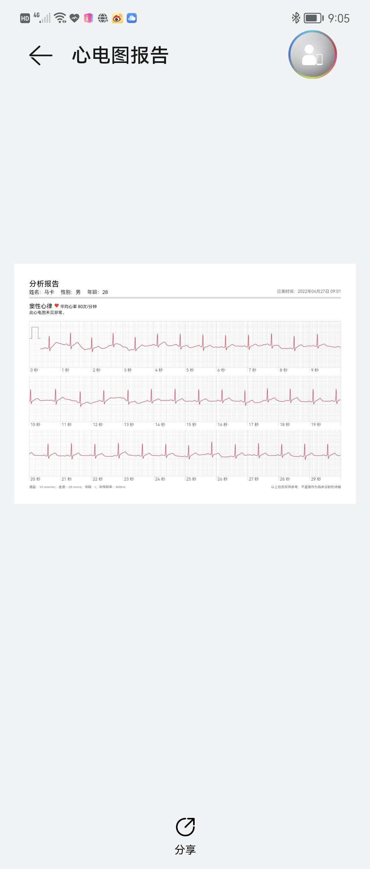 华为手表软件（华为手表连接软件）-第10张图片-欧交易所