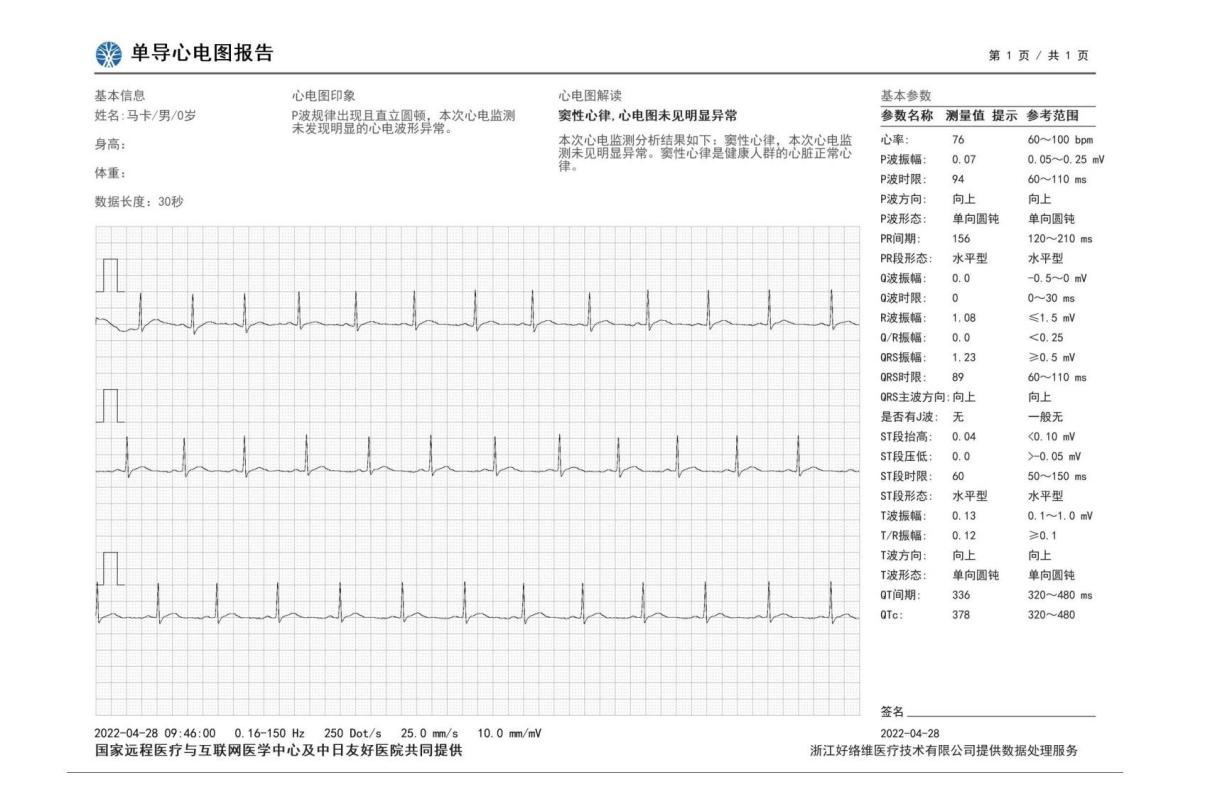 华为手表软件（华为手表连接软件）-第12张图片-欧交易所